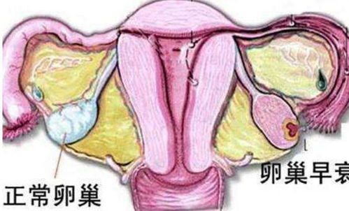 有这3种表现 说明不久之后就要来月经了 有这3种表现 说明不久之后就要来月经了
