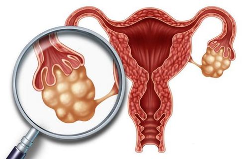 月经时自慰完变成白色 月经时自慰完变成白色