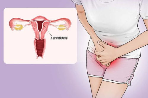 痛经手脚寒凉 痛经手冷 痛经手脚寒凉 痛经手冷