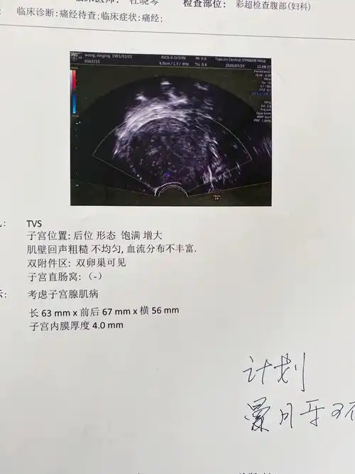 无糖可乐比普通可乐更健康吗 无糖可乐比普通可乐更健康吗