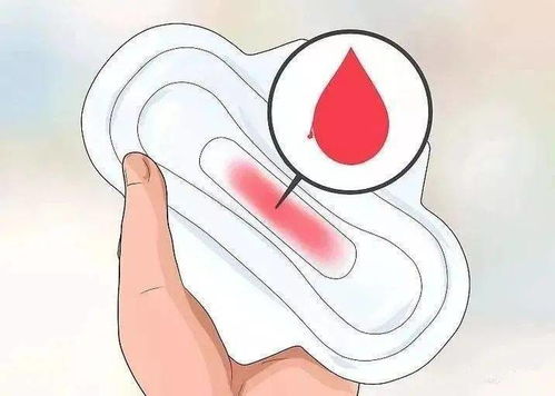 痛经症状治疗多久恢复 痛经症状治疗多久恢复