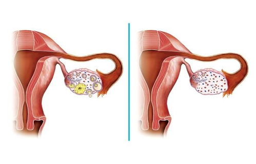 女性月子病多因为肾虚 女性月子病多因为肾虚