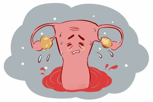 痛经宝颗粒不痛经能吃吗 痛经宝颗粒不痛经能吃吗