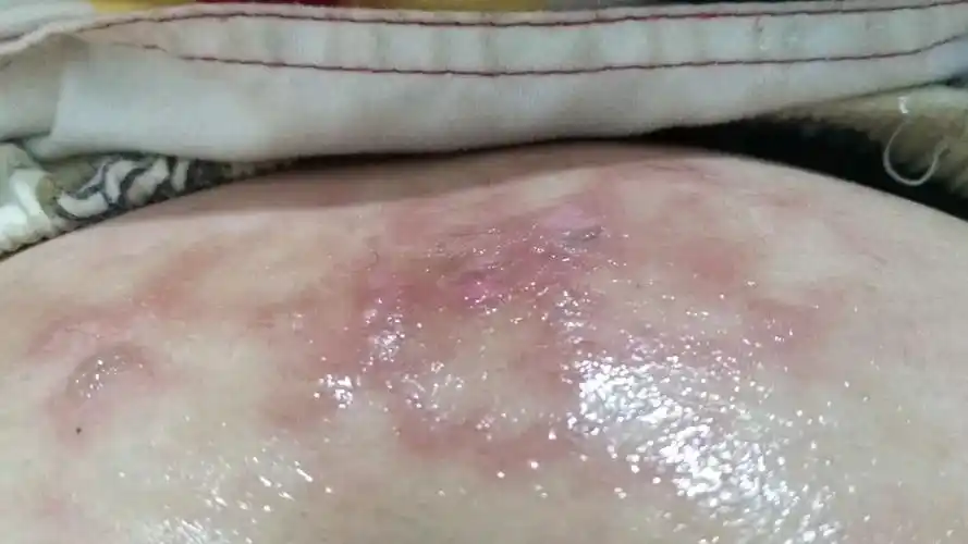 ʹôݲغ컨 غ컨ˮʹЧ