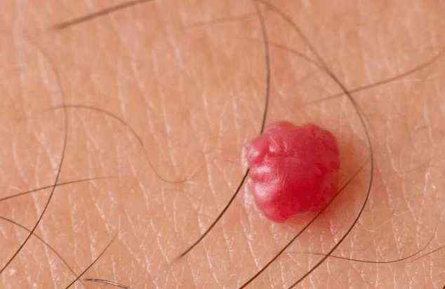 花椒红糖治痛经 花椒加红糖有什么功效可以治 痔疮吗 花椒红糖治痛经 花椒加红糖有什么功效可以治 痔疮吗