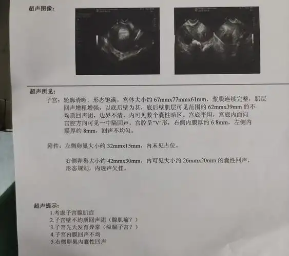产褥期乳腺炎应该如何预防 产褥期乳腺炎应该如何预防