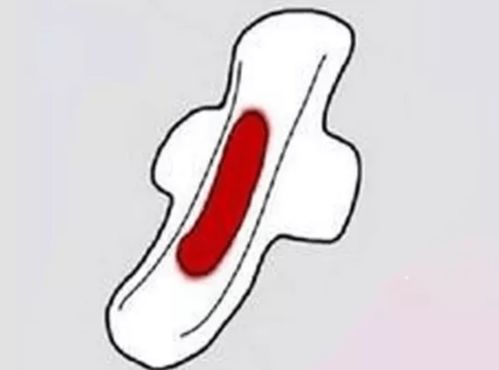 月经期间屁股两边很疼 月经期间屁股两边很疼