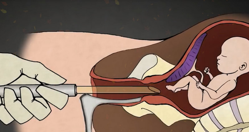 ۴ô죿ȥ۴ɰĦ3Ѩλ