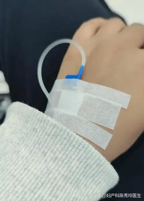 治疗痛经肌肉痛的药物 治疗痛经肌肉痛的药物