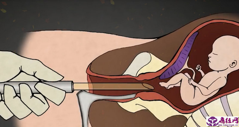 月经期间可以吃油桃吗 月经期间可以吃油桃吗