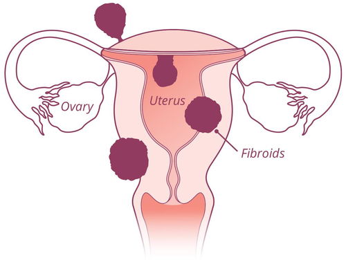 痛经属于生病吗 痛经属于疾病吗 痛经属于生病吗 痛经属于疾病吗