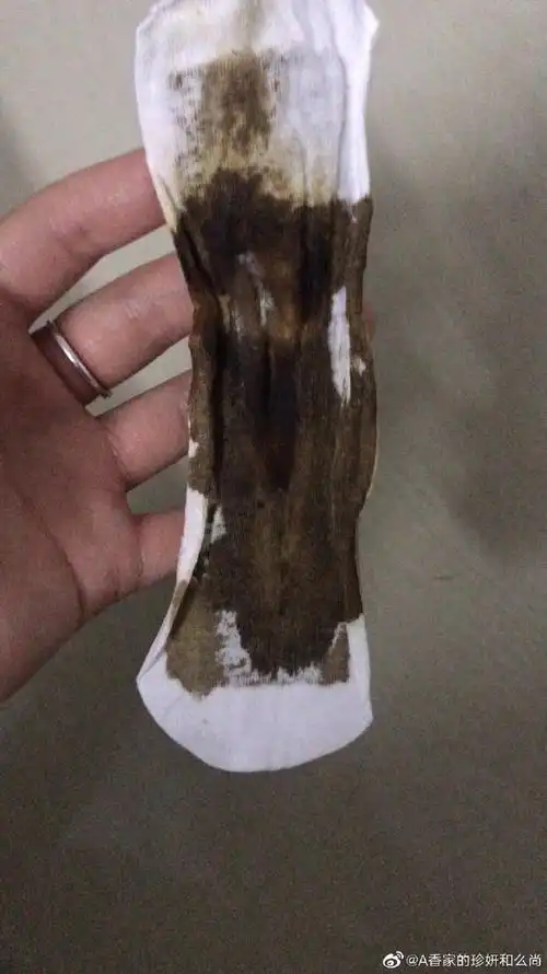 打胎手术前应该注意什么呢 打胎手术前应该注意什么呢