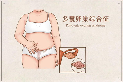 满城尽带黄金甲表达什么意思 满城尽带黄金甲表达什么意思