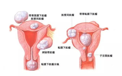 产后月经结束可以同房 产后月经结束可以同房