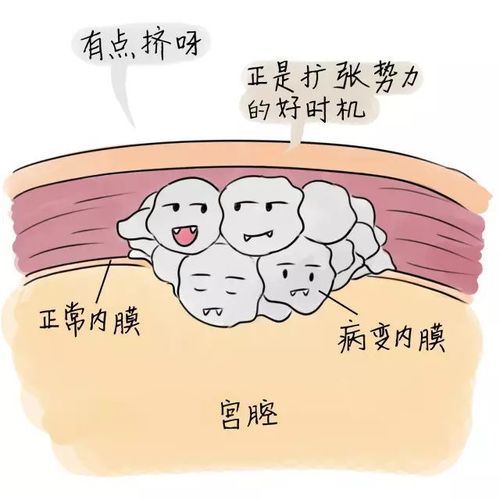 痛经喝头孢喝几个 头孢可以治痛经吗 痛经喝头孢喝几个 头孢可以治痛经吗