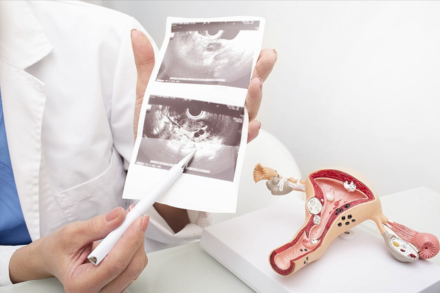 女性一旦有宫外孕怎么办 女性一旦有宫外孕怎么办