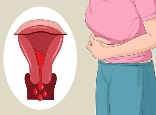 痛经是想要宝宝吗 痛经的感觉和生孩子 样吗 痛经是想要宝宝吗 痛经的感觉和生孩子 样吗