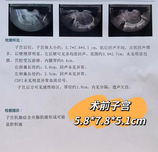 痛经量大挂什么科室 痛经量大挂什么科室