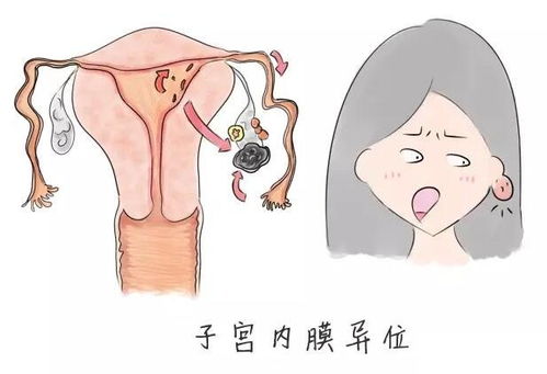 女性须警惕 女性白带发黄很严重 女性须警惕 女性白带发黄很严重