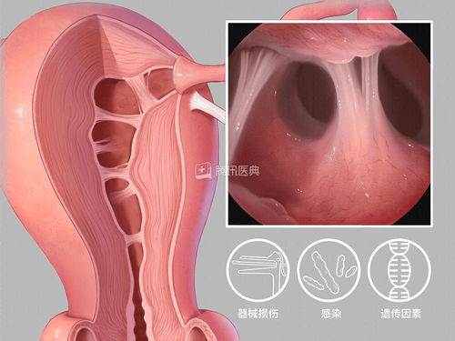 ¾ڿԺ ¾ںöѪųʲô