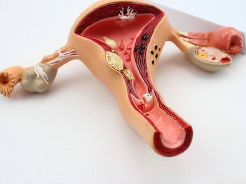 宫颈炎千万别吃这些东西!宫颈炎的饮食禁忌 宫颈炎千万别吃这些东西!宫颈炎的饮食禁忌