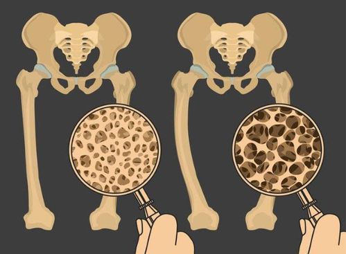 压力太大怎么调理月经 压力太大怎么调理月经