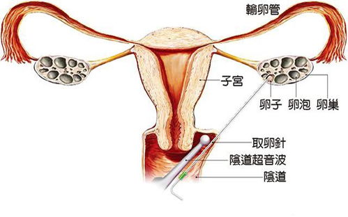 女生痛经难受腰疼 痛经腰疼怎么办缓解疼痛 女生痛经难受腰疼 痛经腰疼怎么办缓解疼痛