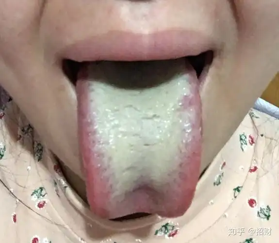 专家表示,有7种体质的女人最容易患子宫内膜癌 专家表示,有7种体质的女人最容易患子宫内膜癌