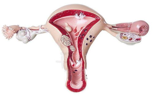 月经期差多囊 来月经多囊的卵泡会排掉吗 月经期差多囊 来月经多囊的卵泡会排掉吗