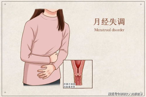 痛经每个月 次正常吗吗 痛经每个月 次正常吗吗