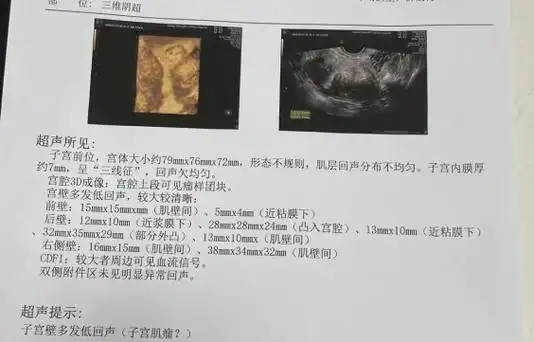 痛经平常怎么调理好 点 痛经平常怎么调理好 点