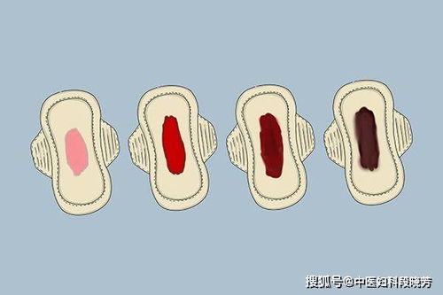 月经每个月都提前三天正常吗 月经每个月都提前三天正常吗