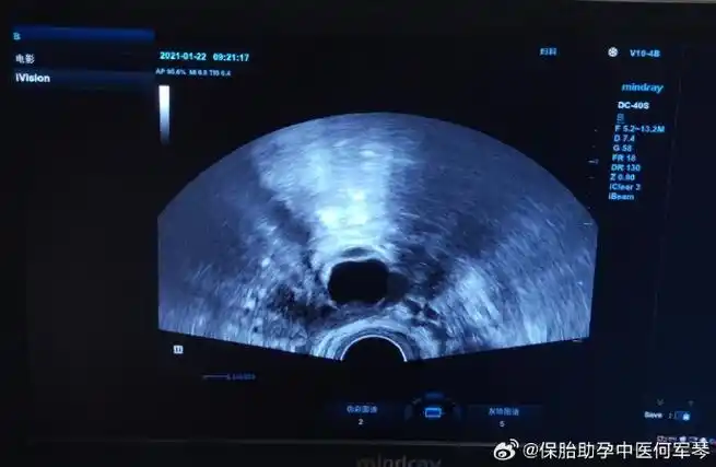 月经后腿疼是什么原因 月经后腿疼是什么原因