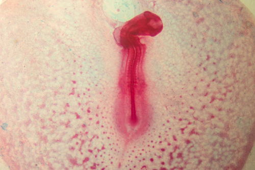 半夜男友安慰女友痛经 半夜男友安慰女友痛经