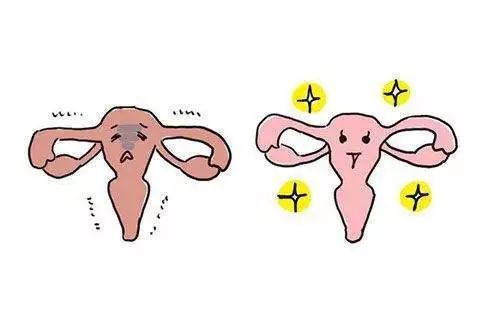 女性子宫异常会有这8种身体状况 女性子宫异常会有这8种身体状况