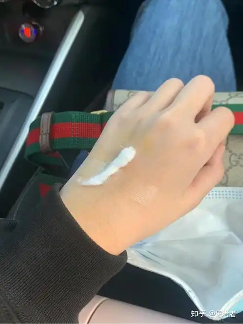 子宫肌瘤会引起癌吗 子宫肌瘤会引起癌吗